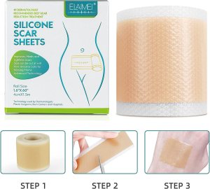 Silicone Scar Tape Roll 1.6”x 120” - Image 3